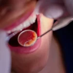 بیمه دندانپزشکی در آلمان